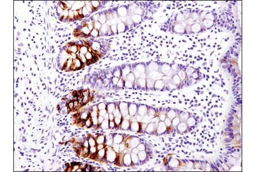 Immunohistochemistry Image 1: OLFM4 (D1E4M) Rabbit Monoclonal Antibody