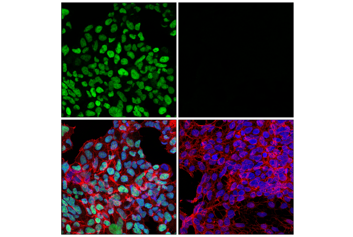 Immunofluorescence Image 1: DLX1 (E4T1L) Rabbit Monoclonal Antibody