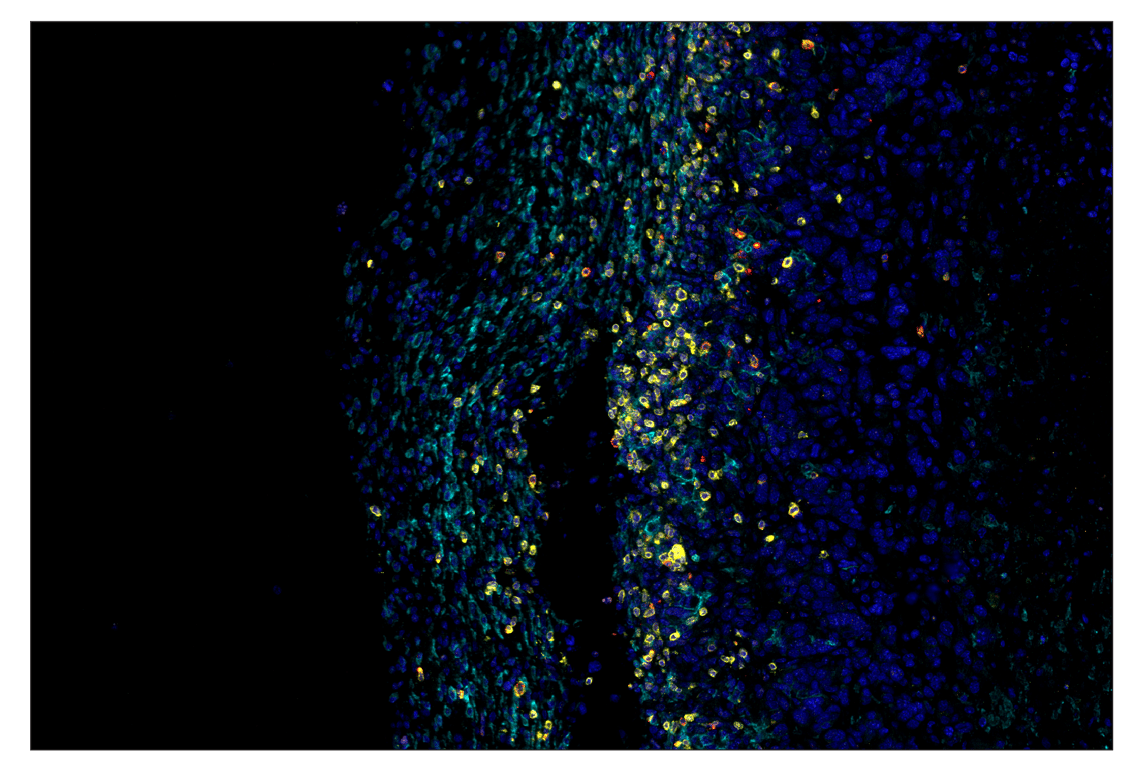 Immunohistochemistry Image 7: Granzyme B (E5V2L) & CO-0049-594 SignalStar<sup>™</sup> Oligo-Antibody Pair
