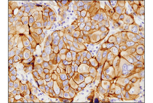 Immunohistochemistry Image 1: FGF Receptor 2 (D4L2V) Rabbit Monoclonal Antibody