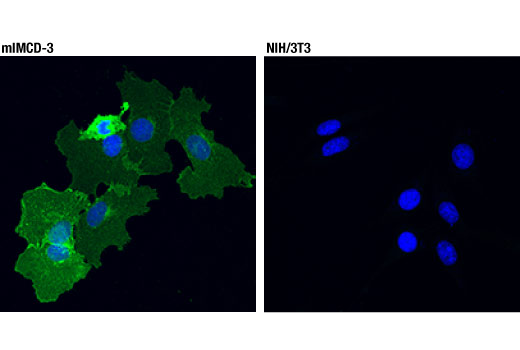 Immunofluorescence Image 1: EGF Receptor (D1P9C) Rabbit Monoclonal Antibody