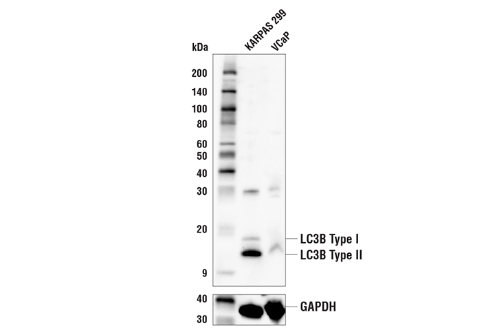 undefined Image 33: Xenophagy Antibody Sampler Kit