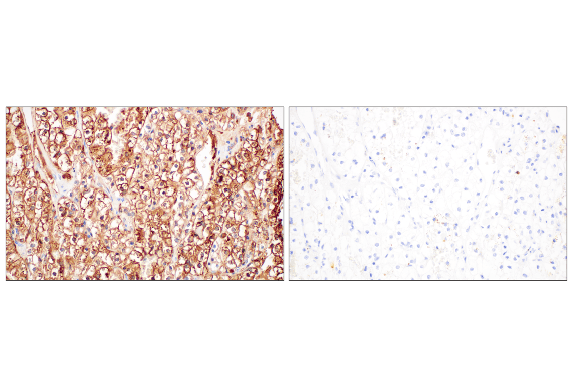 Immunohistochemistry Image 11: FTL (F9O4I) Rabbit Monoclonal Antibody