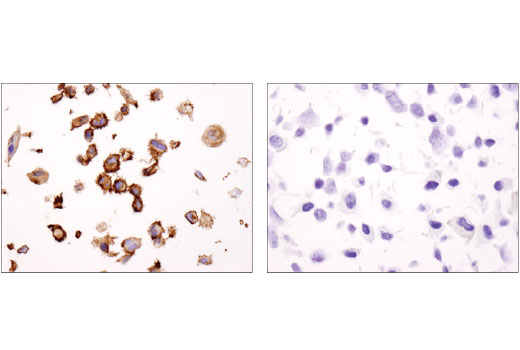 Immunohistochemistry Image 7: EphA2 (D4A2) XP<sup>®</sup> Rabbit mAb (BSA and Azide Free)