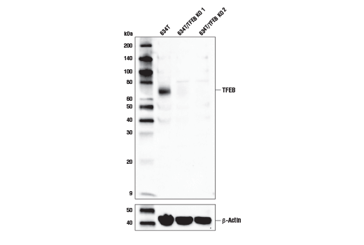 Western Blotting Image 2: TFEB (D4L2P) Rabbit Monoclonal Antibody