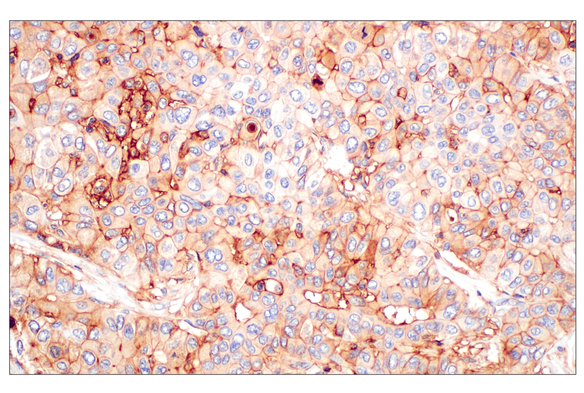 Immunohistochemistry Image 1: CD58 (F1C9B) Rabbit Monoclonal Antibody