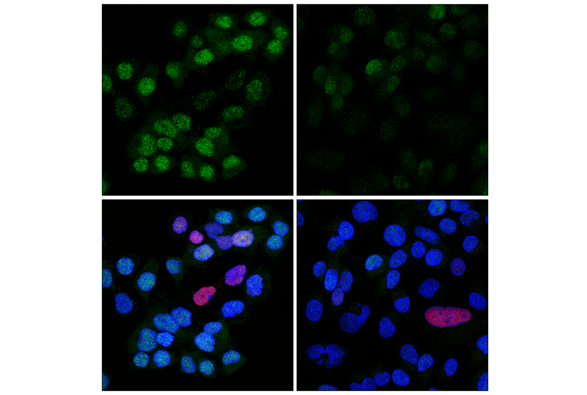 undefined Image 21: PhosphoPlus<sup>®</sup> Chk1 (Ser317) Antibody Duet