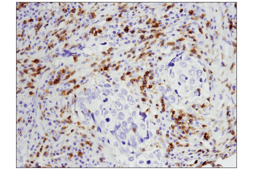 Immunohistochemistry Image 2: CD5 (E8X3S) Rabbit Monoclonal Antibody (BSA and Azide Free)