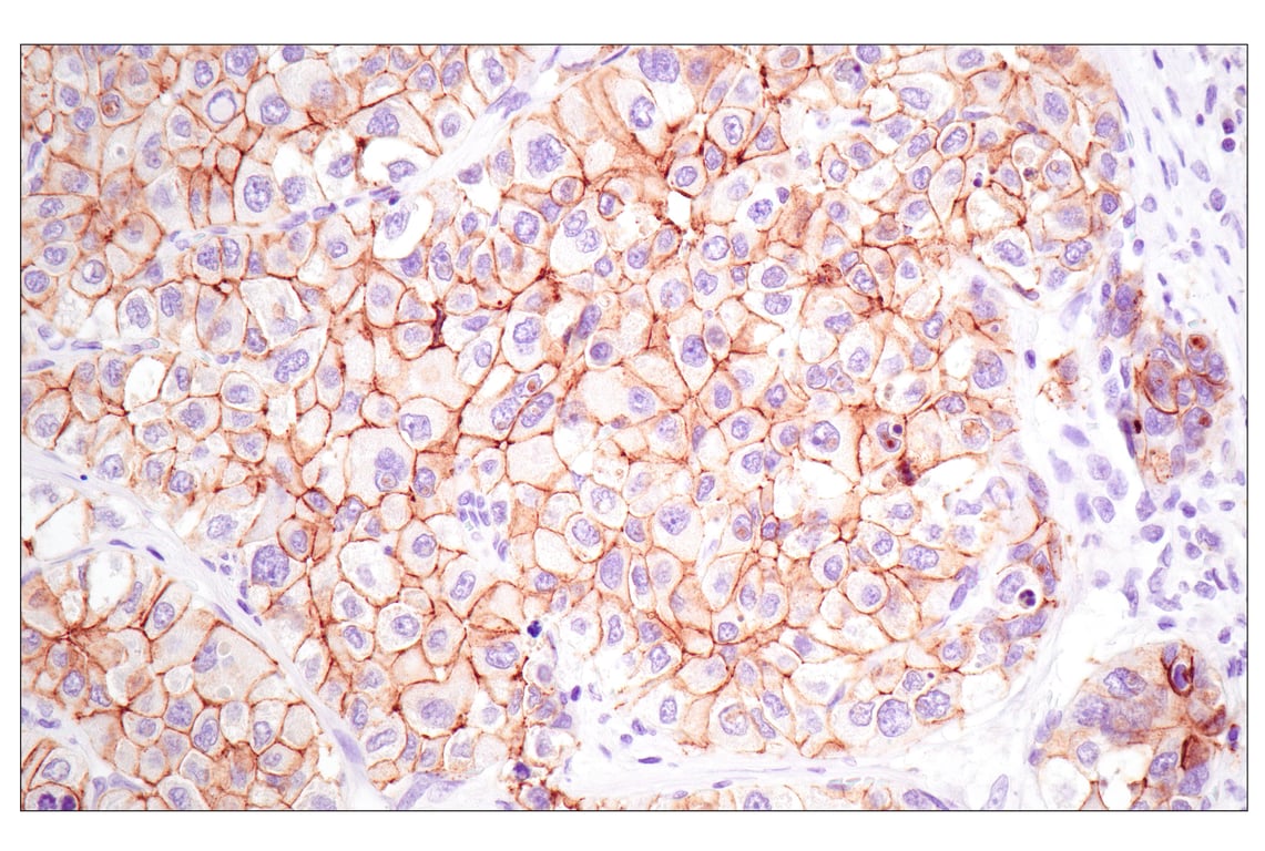 Immunohistochemistry Image 2: E-Cadherin (4A2) Mouse Monoclonal Antibody (BSA and Azide Free)