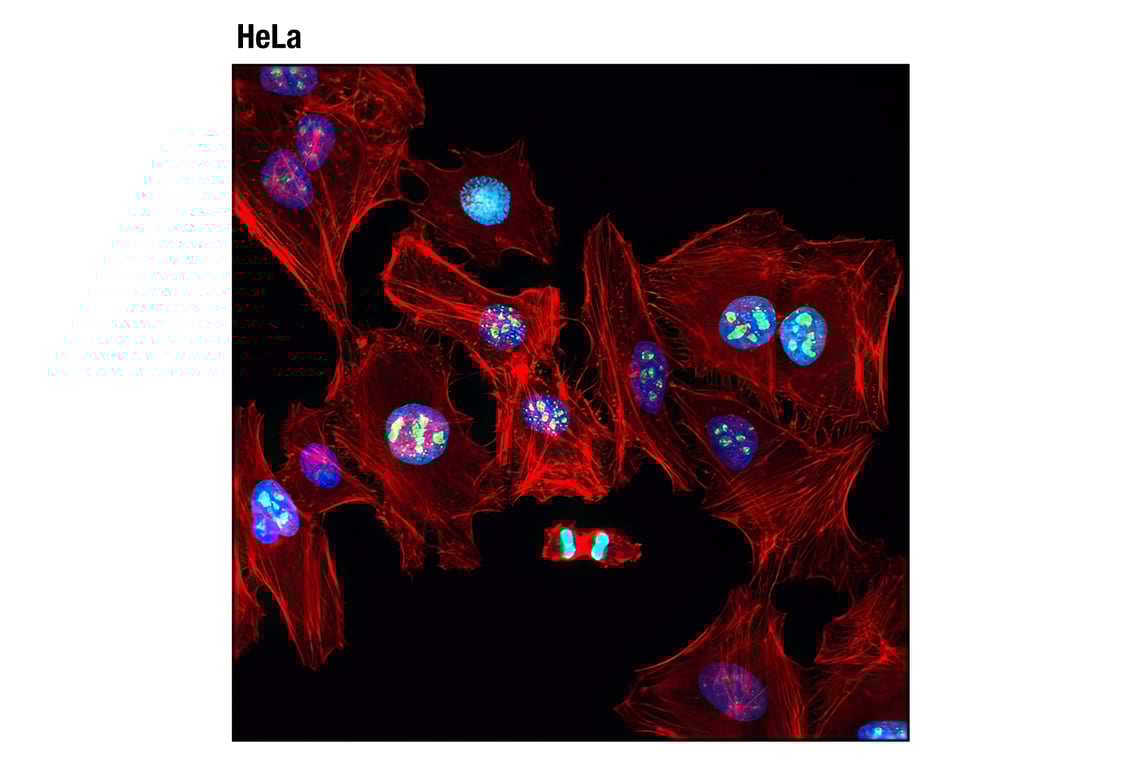 Immunofluorescence Image 1: Ki-67 (8D5) Mouse Monoclonal Antibody (BSA and Azide Free)