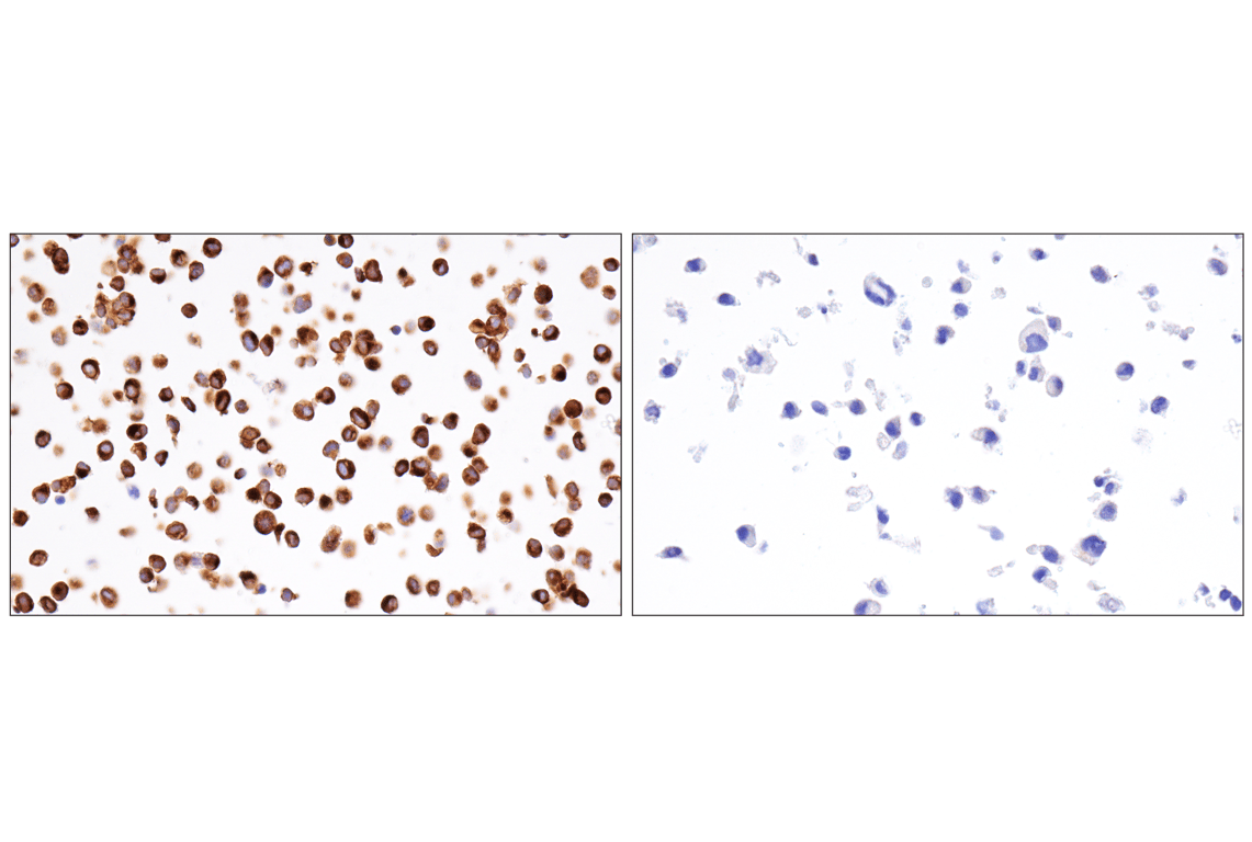 Immunohistochemistry Image 8: Neurofilament-M (E7L2T) Rabbit Monoclonal Antibody (BSA and Azide Free)