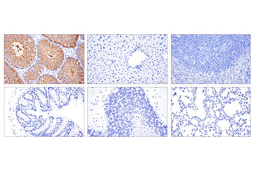 Immunohistochemistry Image 2: Ly6k (E4K8Y) Rabbit Monoclonal Antibody (BSA and Azide Free)