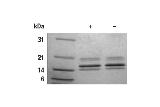 undefined Image 2: Human FGF-4 Recombinant Protein
