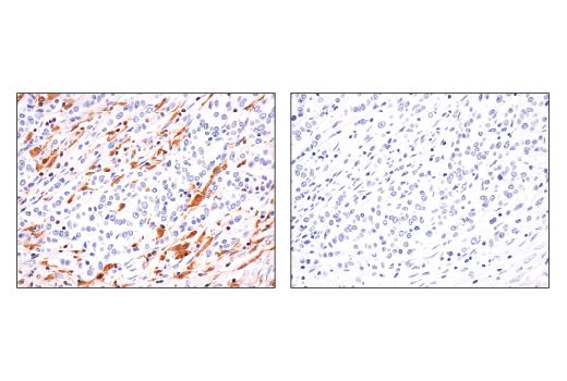 undefined Image 28: Human Reactive Inflammasome Antibody Sampler Kit II