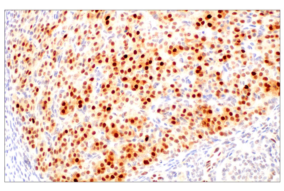 Immunohistochemistry Image 12: ARK5 (E4T2A) Rabbit Monoclonal Antibody