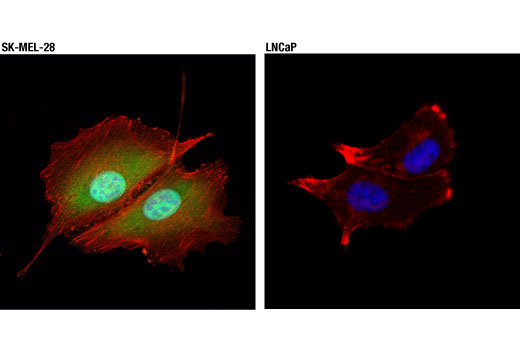 Immunofluorescence Image 1: Galectin-3/LGALS3 (D4I2R) Rabbit Monoclonal Antibody (BSA and Azide Free)