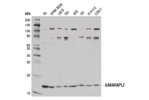 undefined Image 9: Autophagy Atg8 Family Antibody Sampler Kit