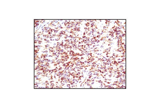 Immunohistochemistry Image 2: HS1 (D83A8) XP<sup>®</sup> Rabbit mAb (BSA and Azide Free)