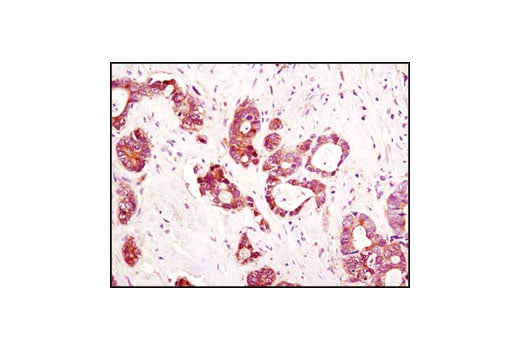 Immunohistochemistry Image 1: LDHA/LDHC (C28H7) Rabbit Monoclonal Antibody