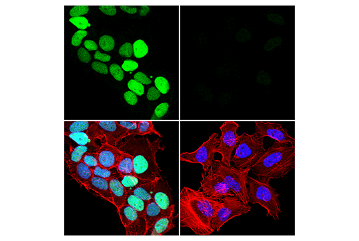 Immunofluorescence Image 1: WIP1 (E2X1I) Rabbit Monoclonal Antibody
