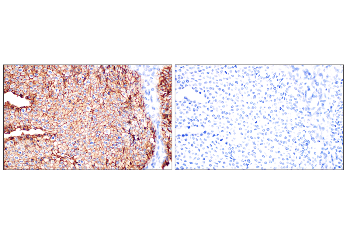 Immunohistochemistry Image 11: TACSTD2/TROP2 (F4W4J) Rabbit Monoclonal Antibody (BSA and Azide Free)