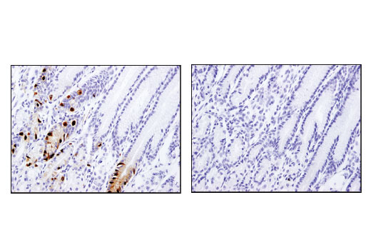 Immunohistochemistry Image 4: PC2 (D1E1S) Rabbit Monoclonal Antibody