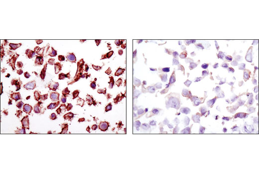 Immunohistochemistry Image 1: HER2/ErbB2 (D8F12) Rabbit Monoclonal Antibody (BSA and Azide Free)