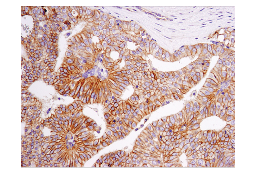 Immunohistochemistry Image 2: PVR/CD155 (D8A5G) Rabbit Monoclonal Antibody (BSA and Azide Free)