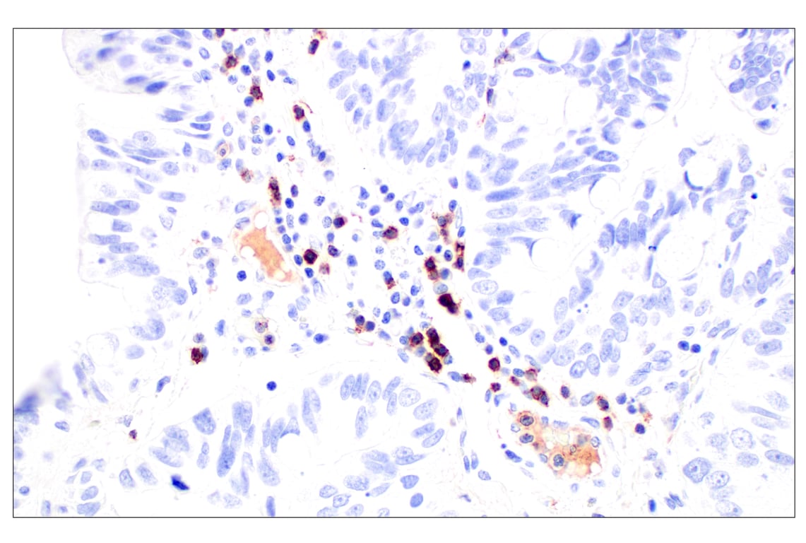Immunohistochemistry Image 6: CD62L/L-Selectin (E7X9I) Rabbit Monoclonal Antibody (BSA and Azide Free)