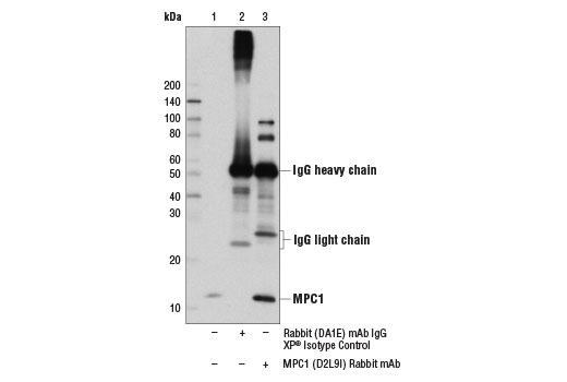 undefined Image 24: Tricarboxylic Acid Cycle Antibody Sampler Kit