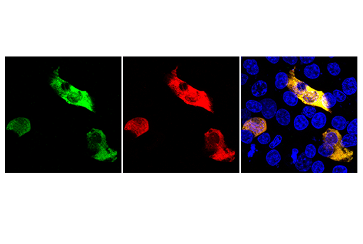 Immunofluorescence Image 1: LbCpf1/Cas12a (Strain <i>ND2006</i>) (E8B1W) Rabbit Monoclonal Antibody