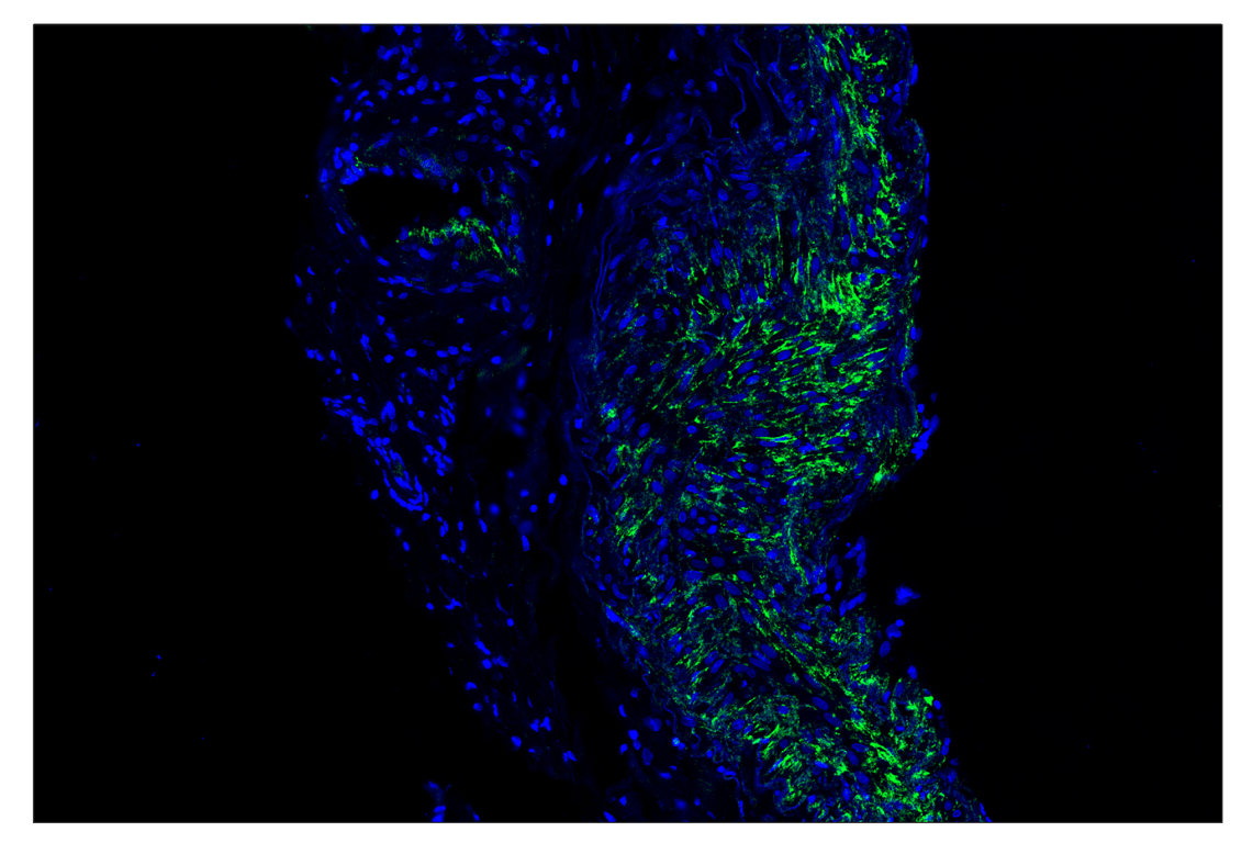 Immunohistochemistry Image 1: Fibronectin/FN1 (E5H6X) & CO-0203-594 SignalStar<sup>®</sup> Oligo-Antibody Pair