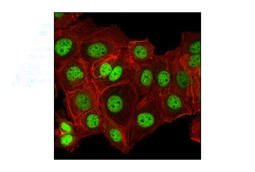 undefined Image 16: Lysine Methyltransferase Antibody Sampler Kit