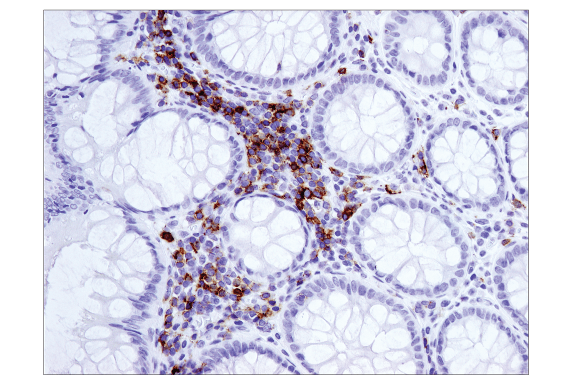 Immunohistochemistry Image 1: ICOS (D1K2T<sup>™</sup>) Rabbit mAb