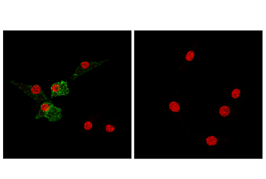 Immunofluorescence Image 1: CD11c (D1V9Y) Rabbit Monoclonal Antibody (BSA and Azide Free)