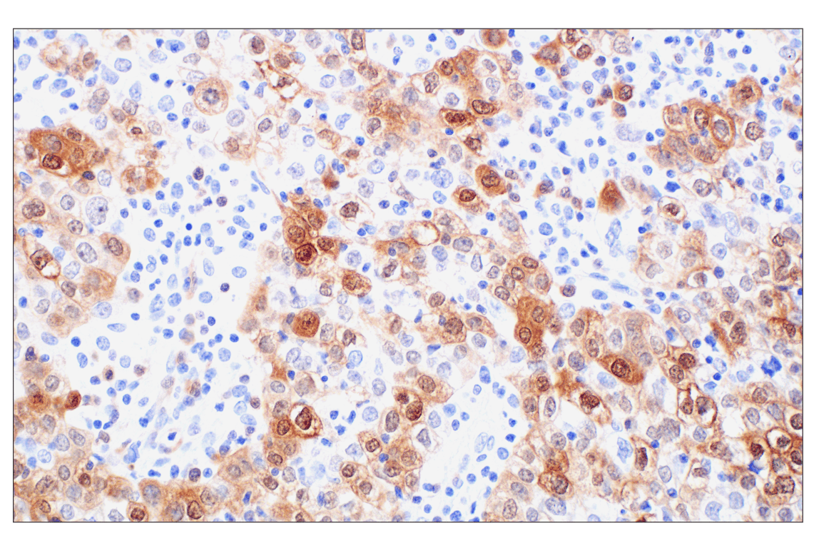 Immunohistochemistry Image 1: PBK/TOPK (F2X2Z) Rabbit Monoclonal Antibody