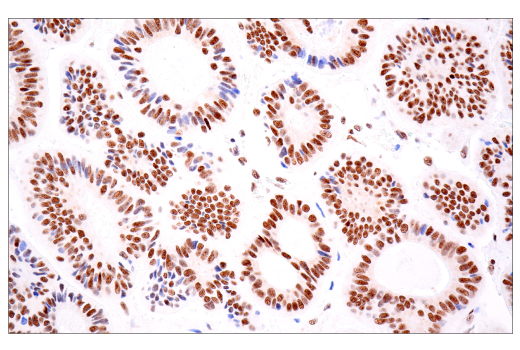 Immunohistochemistry Image 11: TDP43 (E2G6G) Rabbit Monoclonal Antibody