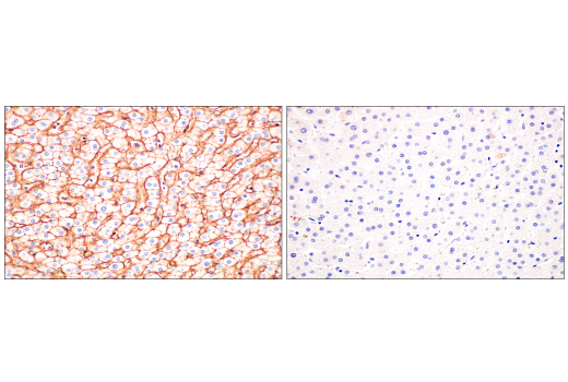 Immunohistochemistry Image 10: CD81 (D3N2D) Rabbit Monoclonal Antibody (BSA and Azide Free)