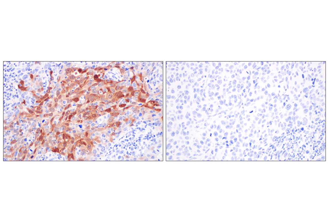 SERPINB3 (F3Z8E) Rabbit Monoclonal Antibody | Cell Signaling