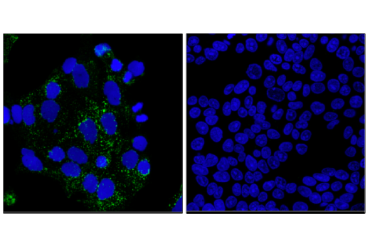 Immunofluorescence Image 1: LAMP3/CD208 (E6E5U) Rabbit Monoclonal Antibody