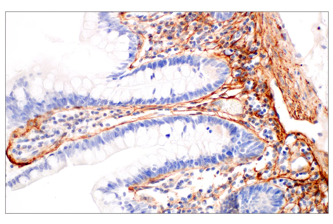 Immunohistochemistry Image 7: Tenascin C (E6N4L) Rabbit Monoclonal Antibody (BSA and Azide Free)