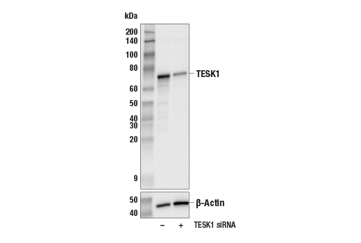 Western Blotting Image 2: TESK1 (D49D4) Rabbit Monoclonal Antibody