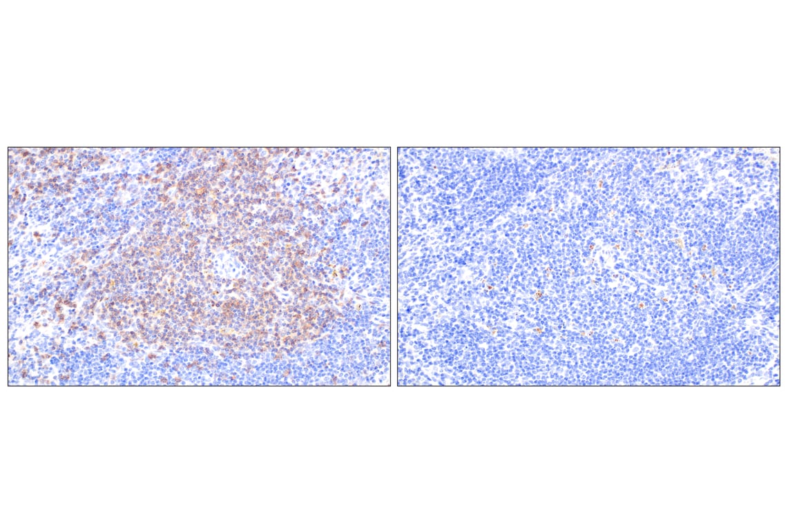 Immunohistochemistry Image 6: CD6 (E9Q1V) Rabbit Monoclonal Antibody (BSA and Azide Free)