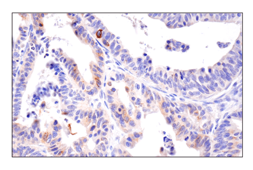 Immunohistochemistry Image 2: 4-1BBL/CD137L/TNFSF9 (E8W3P) Rabbit Monoclonal Antibody (BSA and Azide Free)