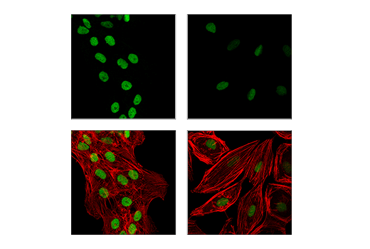 Immunofluorescence Image 1: EED (E4L6E) Rabbit Monoclonal Antibody