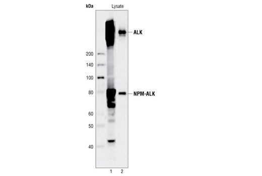 ELISA Image 3: PathScan<sup>®</sup> Total ALK Sandwich ELISA Kit