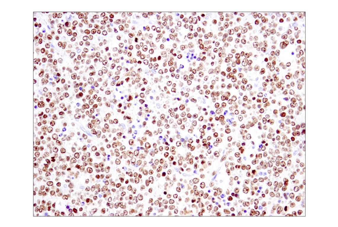 Immunohistochemistry Image 2: Ikaros (D6N9Y) Rabbit Monoclonal Antibody