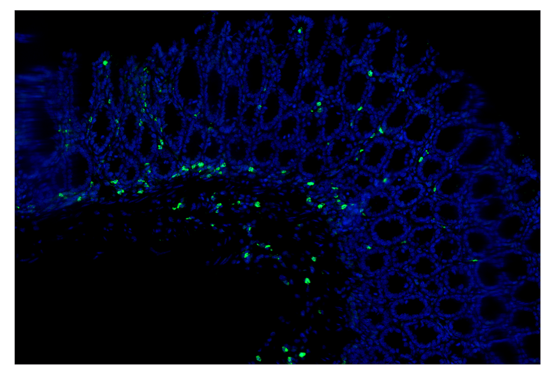 Immunohistochemistry Image 2: Neutrophil Elastase (E8U3X) & CO-0137-647 SignalStar<sup>™</sup> Oligo-Antibody Pair