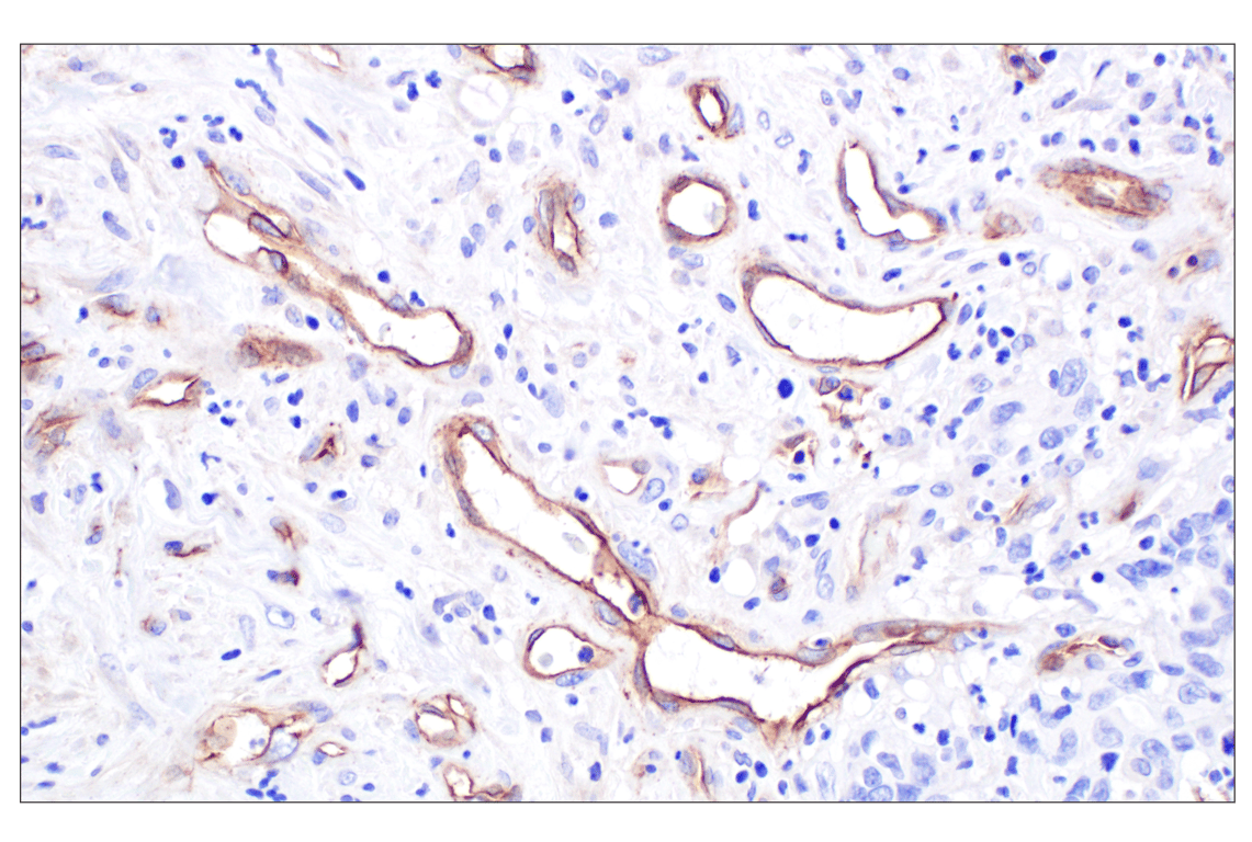 Immunohistochemistry Image 1: CD105/Endoglin (F9C5Q) Rabbit Monoclonal Antibody