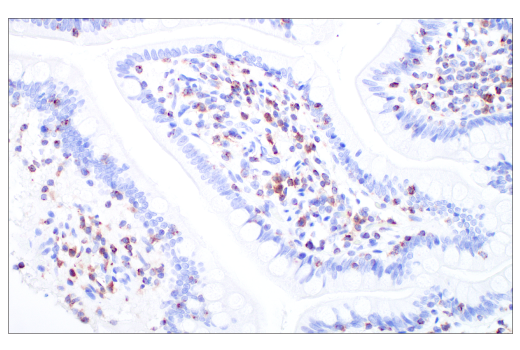 Immunohistochemistry Image 9: Glut3 (E7M7V) Rabbit Monoclonal Antibody